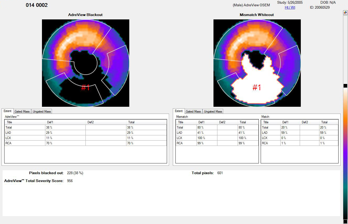 AdreView polar maps and quantitative scores