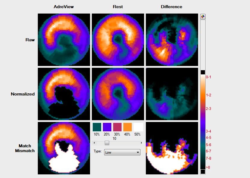 AdreView mismatch nine polar maps