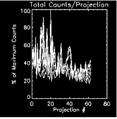 in atrial fib, there is curve separation plus narrow peaks