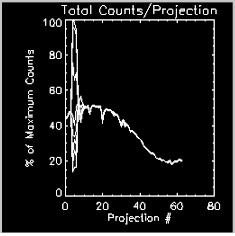 with transient tachycardia, all curves separate for a short range of projections