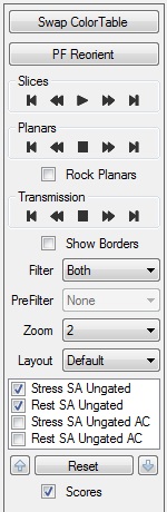 slice screen options