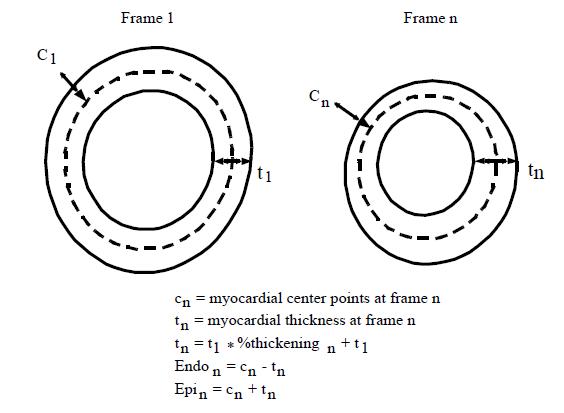 diagram of LV slice center points