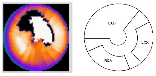 generic coronary territories